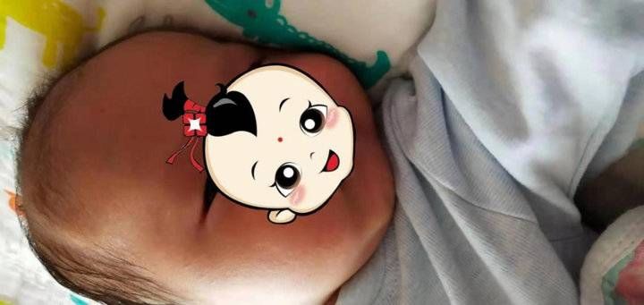 男婴|网上寻医 远程问诊喜获男婴