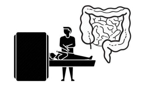 癌肿|晨起一个症状，可能是肠癌“征兆”，很多人都忽视了！