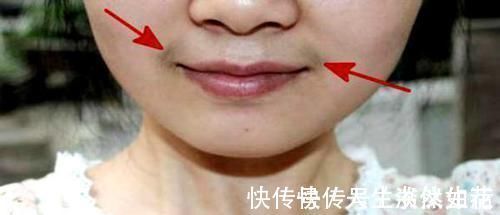 胡须|12岁少女长出胡须,医生告诫有些食物别让孩子乱吃