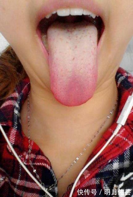 舌苔|宝宝有这4个表现,说明他积食,大人可别大意了,吃它积食消得快