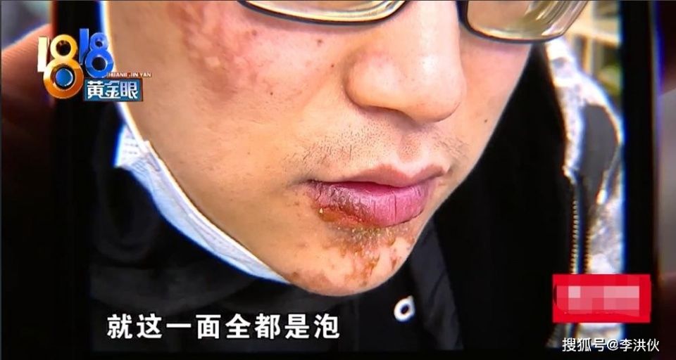 陈赫火锅分店天花板弄伤客人，原本是明星投资样板，差点砸了招牌