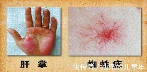 肠胃道|50岁进入生命黄金期,保持身体“1处软、2处通”,身体健康易长寿