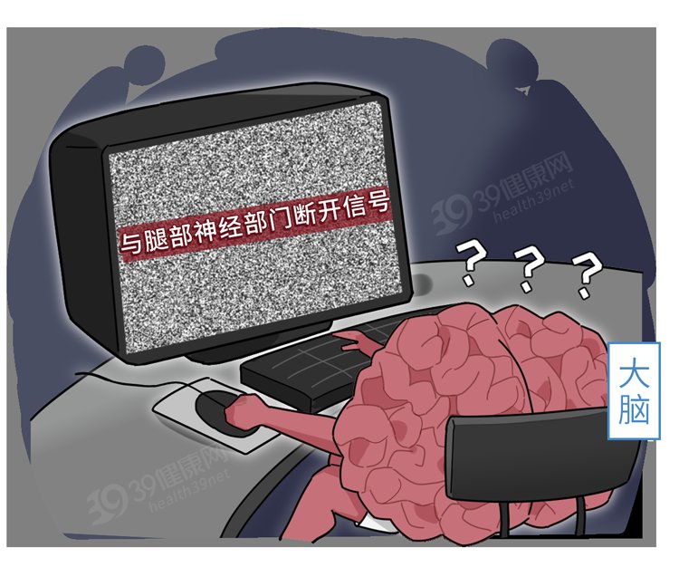 姿势|蹲完厕所后,我的腿有好多“雪花点”在动!这种腿麻简直酸爽