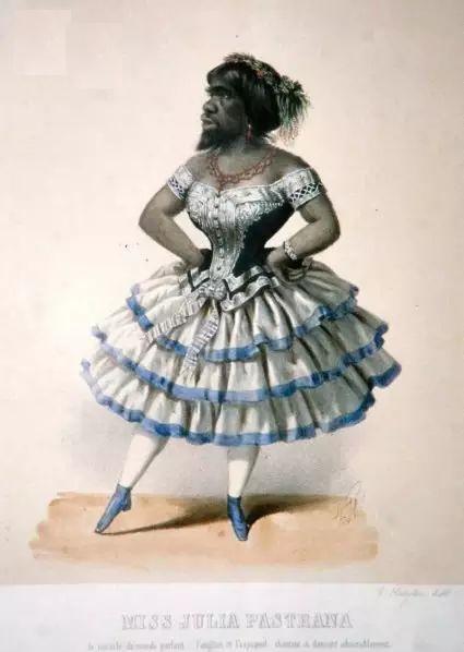 出生|史上最丑的女人,生前轰动一时,死后被丈夫制成标本展览154年