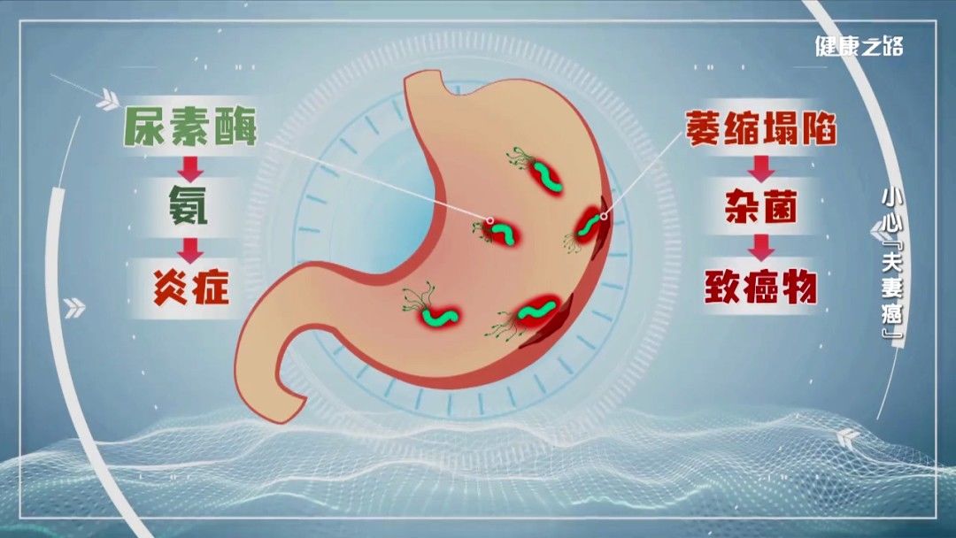 高危因素|“执子之手，与子偕老”，别让“夫妻癌”成为恩爱和睦家庭的绊脚石！