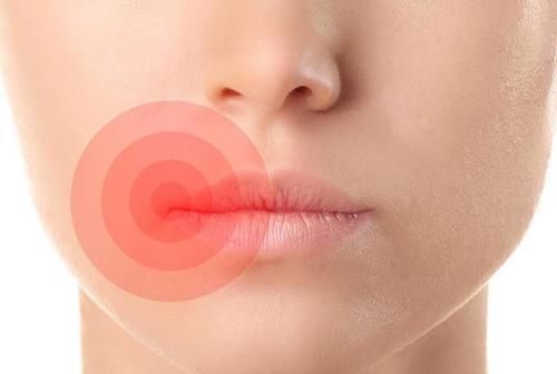 透过“唇色”看健康,嘴唇出现这六种现象,提示疾病已经“临门”