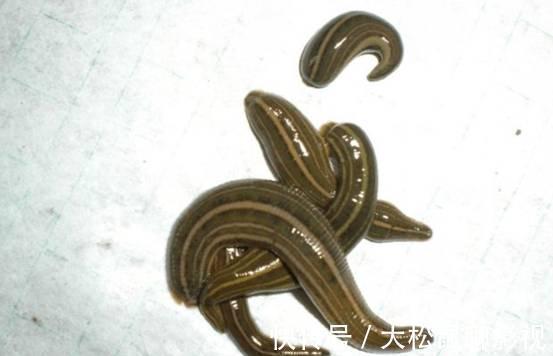 男孩|蚂蟥能在人体内长期存活吗?5岁男孩不小心吞进肚,1年后才发现