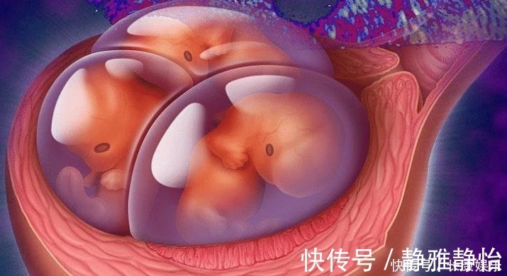 小王|孕妇怀孕3个月，肚子大到行动不便，孕检后一家人很纠结