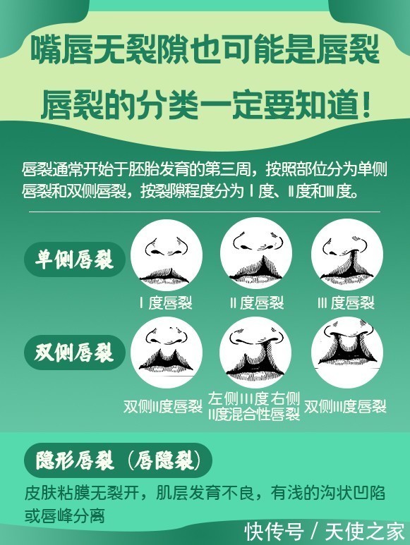 张磊涛|《天使科普》关爱兔唇宝宝 张磊涛教授带你了解唇腭裂