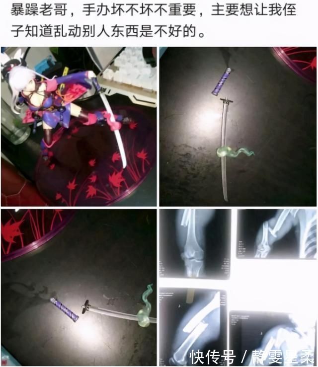 小孩子|熊孩子毁坏叔叔手办,惨被打到骨折,亲情和手办谁更重要?