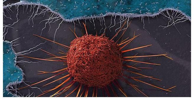 hpv|29岁女子宫颈癌离世,从不碰辣椒,医生:2个坏习惯会糟蹋宫颈