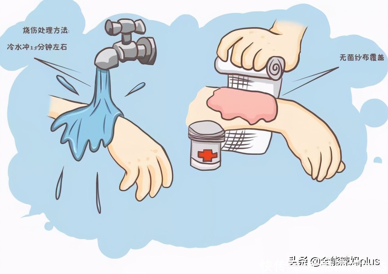 水泡|4岁娃掉入170度油锅,奶奶3步救下孩子,医生:比我内行