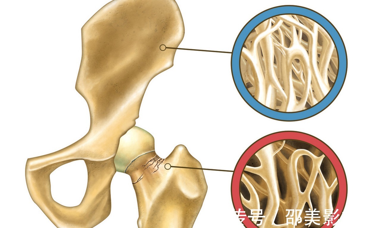 黄酒|骨科专家:1碗白萝卜汤,坚持2个月腰背不疼,骨质疏松和你说再见