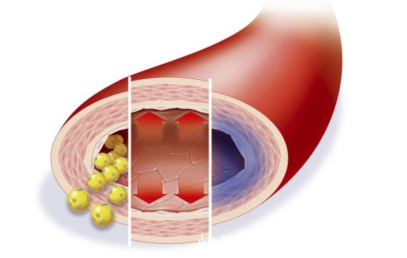 糖尿病|心脑血管病、高血压、糖尿病都怕一个字，医生强力推荐，人人可学