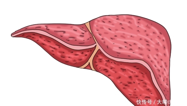 从乙肝到肝硬化,不是没症状,异常集中出现时,或得要多重视下