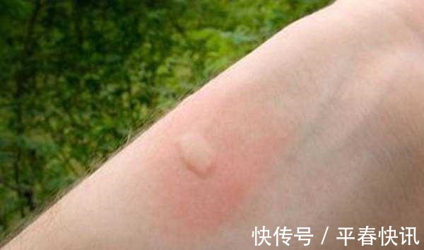 隔夜的茶水别着急倒了,用处其实很多,很多人都浪费了