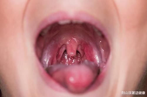 抑菌|天然“青霉素”被找到,不是大蒜,敞开肚子吃,消炎抑菌,咽炎不敢造次!