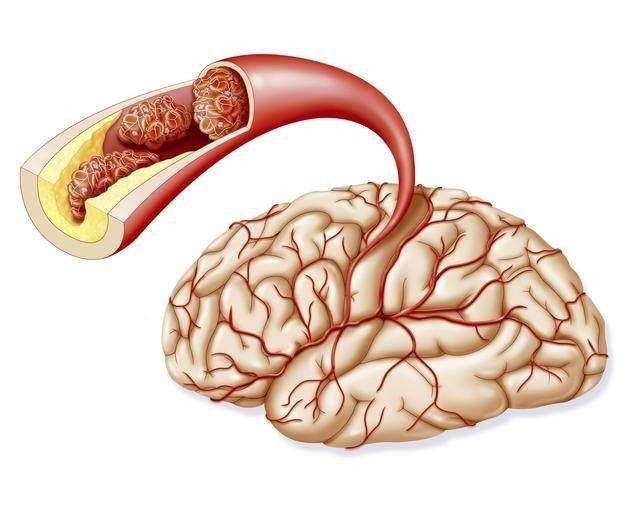 胆固醇|两种米是高血压高血脂克星，长寿的人在吃，血管完好如初