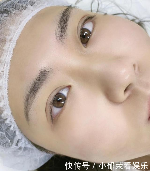 脸部|整容失败的“风险”有多大?额头凹陷、眼皮肉条,看完你还心动吗