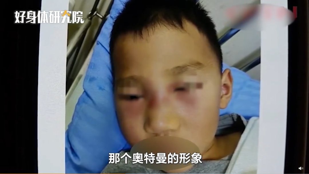 对症治疗|五岁男孩爱挖鼻孔，结果脸肿了