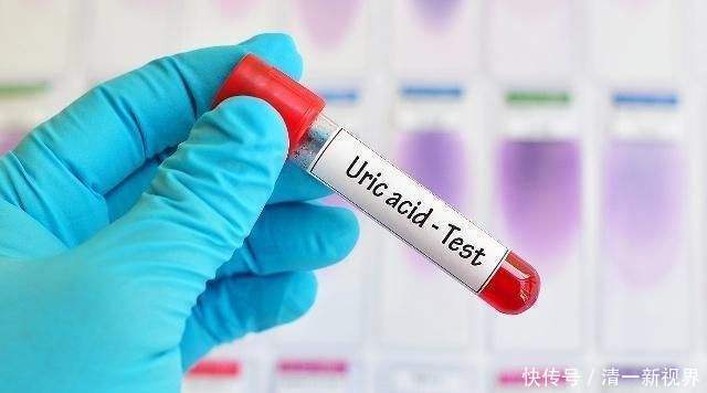 在厨房的降酸高手,没事吃一点,痛风不靠近