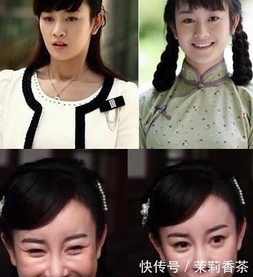 鼻梁|长期注射玻尿酸的人,皮肤会撑开变松弛?专业整形顾问告诉你