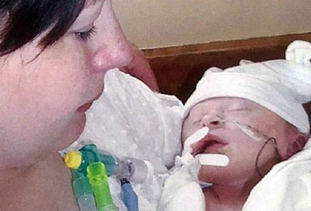 死亡|孕妇破水15小时,生产后娃“意外”死亡,家属孩子是被产钳夹死