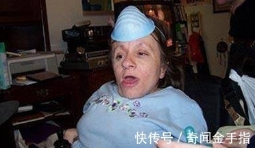 斯泰茜|美国身高70厘米的袖珍妈妈，身体肿如气球，如今俩孩子