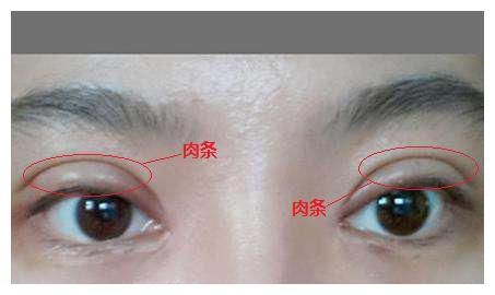 你真的知道吗?【医美误区】