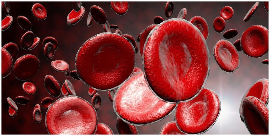 动脉硬化|血脂高不高,看脸就知道,若没有这3个症状,恭喜血脂控制得不错