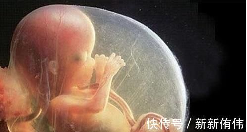 子宫|孕检B超四维时胎儿害羞不动,孕妈别着急,8个技巧让孩子活跃配合你