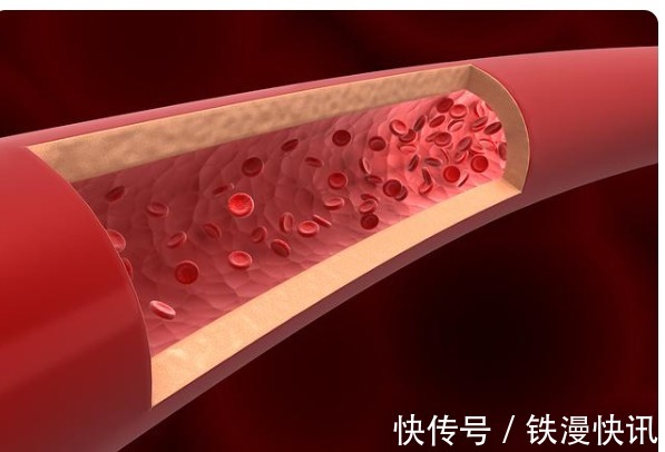 组氨酸|请停止吃这5种鱼，可能含寄生虫和重金属，看看你是否爱吃