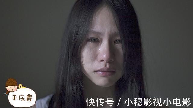 蜘蛛|肝硬化早期要注意!身上长出“这三物”,及时诊察避肝癌