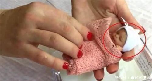 早产|14年过去,原本身体巴掌大“世界最小宝宝”,如今颜值高到认不出