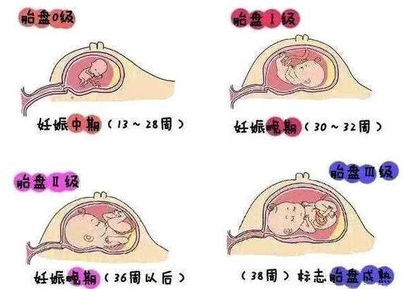 胎儿|孕晚期最后一个月,做产检时,要记得问医生4个问题!