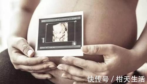 李芳|怀孕后，为啥有人孕吐不断，有人却没反应，医生与2个因素有关