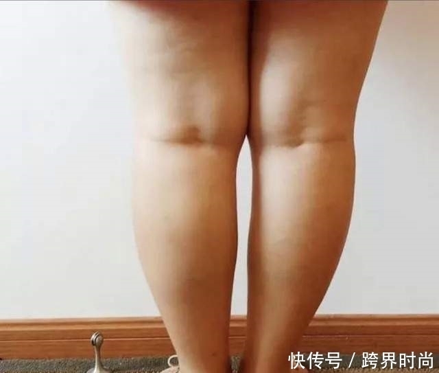 高跟鞋|五个月，腿围从53cm瘦到42cm，纯个人经验+干货分享