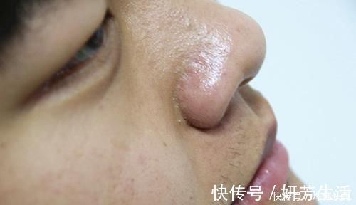 眼睛|肝癌不会突然发生！医生：身体会给3次机会，若不抓住，后悔莫及