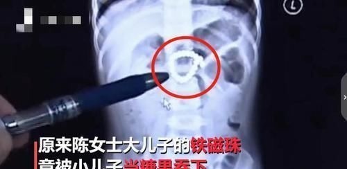 纽扣电池|两岁宝宝总是肚子痛还经常吐绿水，带去医院检查后，妈妈崩溃了……