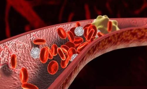 餐桌上的“阿司匹林”,每天坚持吃,消血栓、通血管,改善心血管