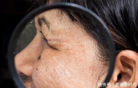 解毒|肝不好可能有3个表现,常吃2种“解毒王”,或许肝病不攻自破