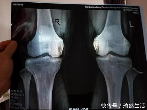 身高速度|当孩子出现这3个信号，说明长身高进入倒计时，早发现早“冲刺”