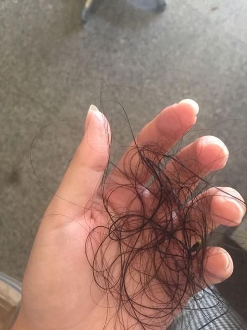 冬天|为什么冬天洗头掉发更多?别再吓唬自己了!