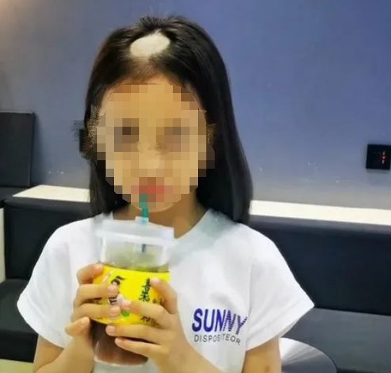 回家|带回家才几天,女儿头顶“秃”了!妈妈崩溃:我悔啊...