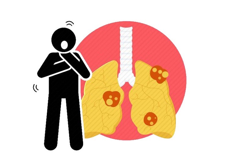 黑木耳|吸烟有害健康!老烟民们,不妨多吃3种食物,给自己的肺减轻负担