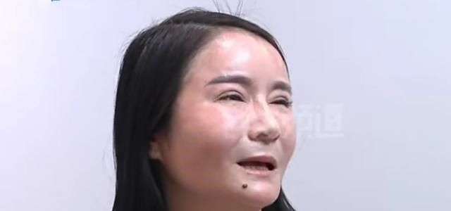 河南女子做免费整形后，怀念以前馒头脸，老公：笑起来像哭一样！