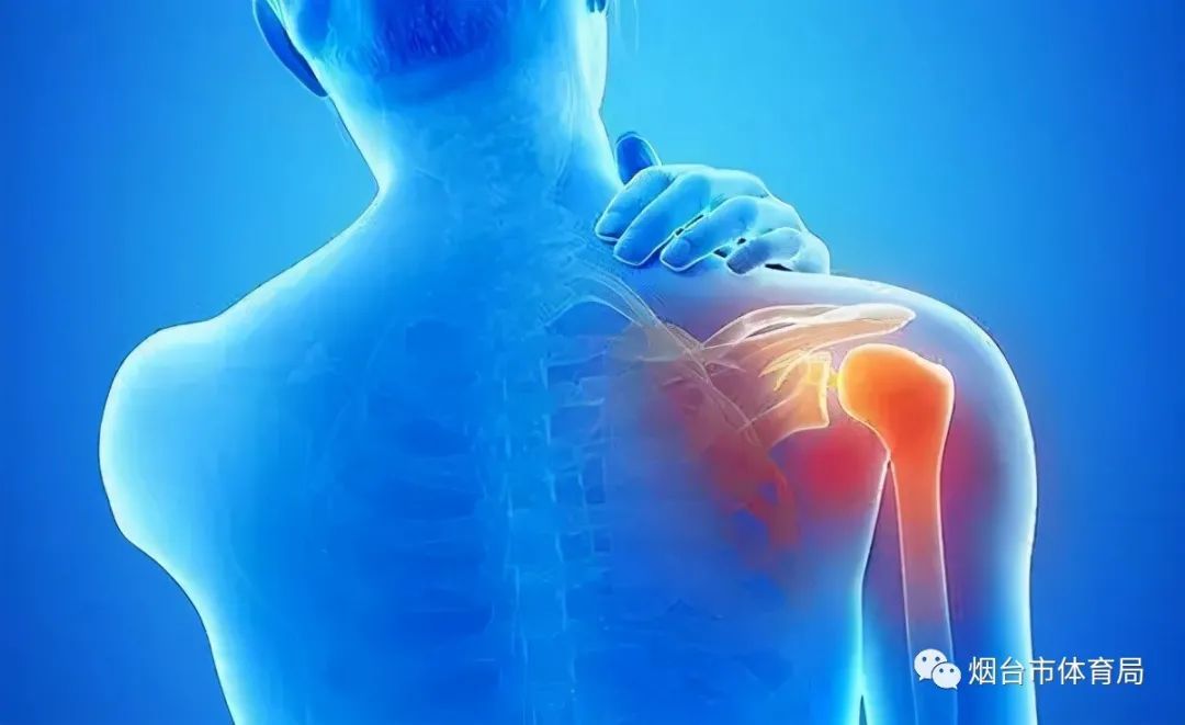 关节|运动后发生肩痛应警惕肩袖损伤