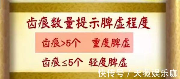 健脾养胃|脾胃差，鸡内金与它们搭配，经常喝一点，健脾养胃，清除脏腑垃圾