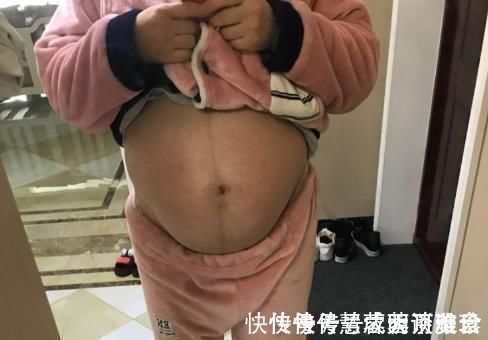 胎儿|好丑?产检单上的胎儿,和实际胎儿有哪些差异?