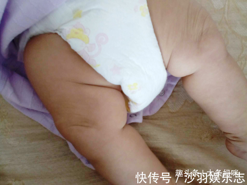 腿纹|腿部可以看出健康问题,宝宝双腿出现3种情况,妈妈不能小觑